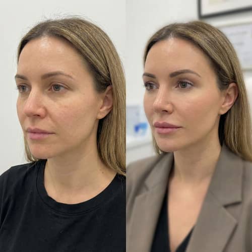 What Would I Look Like With Plastic Surgery? What Would I Look Like With Plastic Surgery?