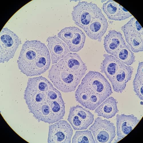 Canine and Feline Lymphoma Cells Under Microscope Canine and Feline Lymphoma Cells Under Microscope