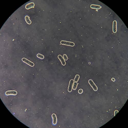 Understanding Bordetella Pertussis: Whooping Cough Agent