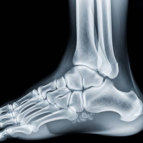 Human Foot X-ray: Anatomical Revealing of Bones and Joints