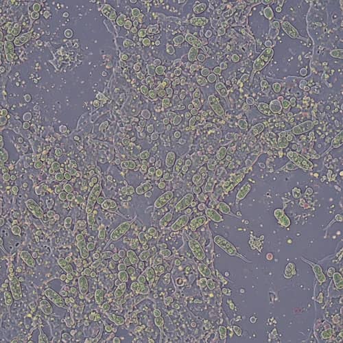 Diverse Microbial Biofilm: Structures & Chemistry Insights