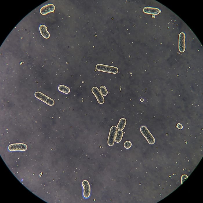 Understanding Bordetella Pertussis: Whooping Cough Agent Understanding Bordetella Pertussis: Whooping Cough Agent