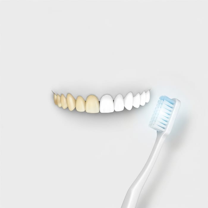 Minimalist Teeth Whitening: Achieve a Bright Smile Minimalist Teeth Whitening: Achieve a Bright Smile