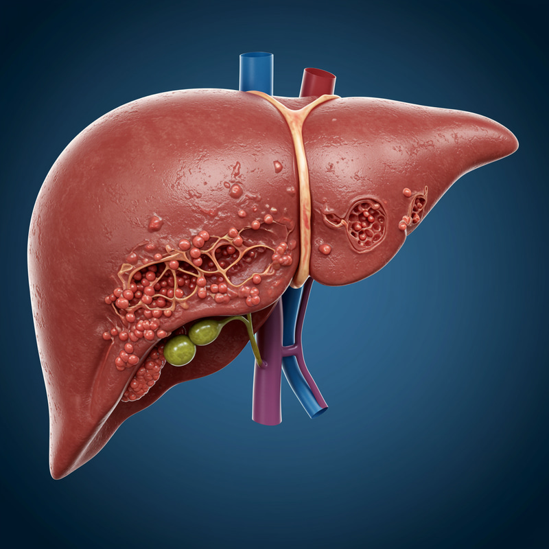Understanding Liver Cirrhosis: Causes & Treatment