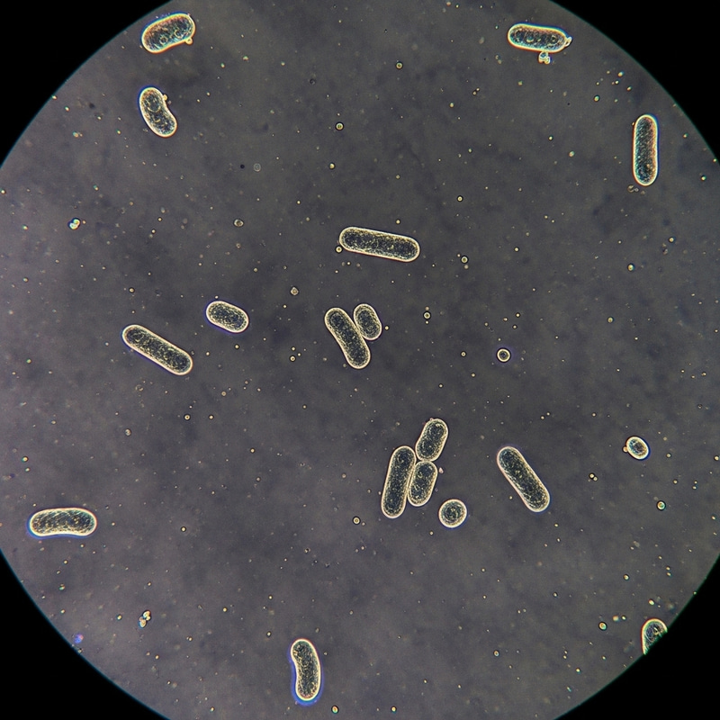 Understanding Bordetella Pertussis: Whooping Cough Agent