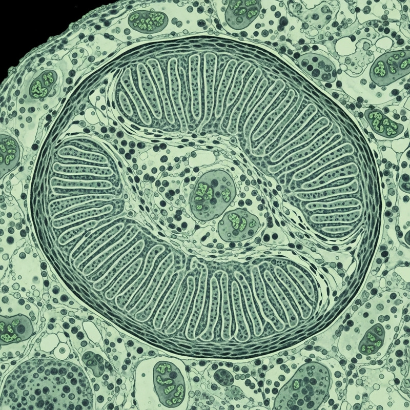 Cross-Section of Striated Muscle Cell