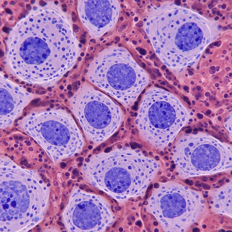 Microscopic Insights into Fibroblasts' Structure Microscopic Insights into Fibroblasts' Structure