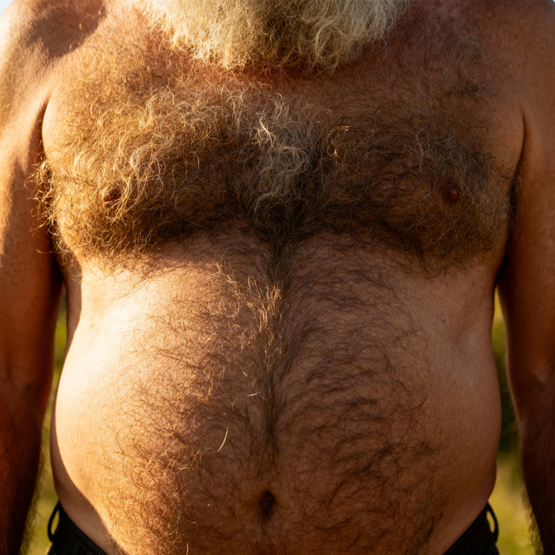 Extremely Hairy Old Man: Unique Features Explained Extremely Hairy Old Man: Unique Features Explained